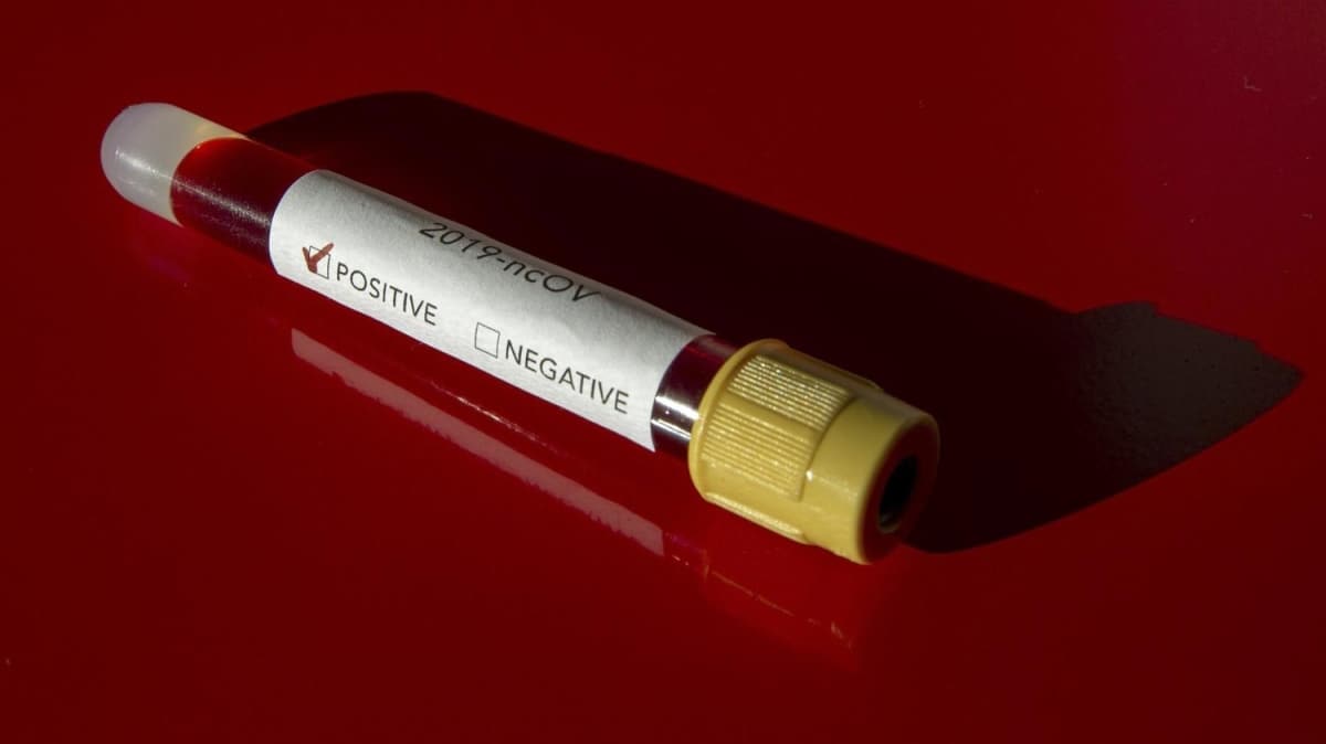 Avrasya lkelerinde koronavirs vakalar artyor 