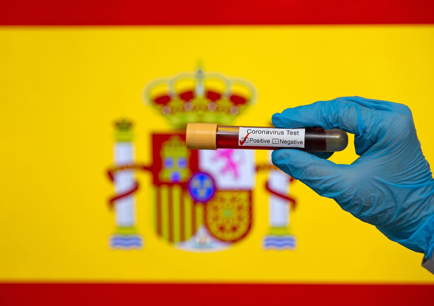 �spanya'dan yeni ad�m: Antikor testlerine ba�lad�