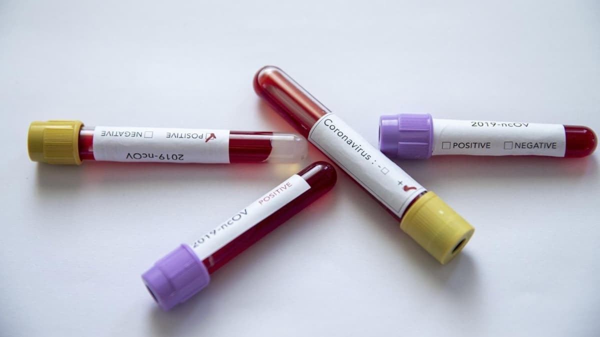 Hubey'de koronavirs nedeniyle tedavi edilen hasta kalmad