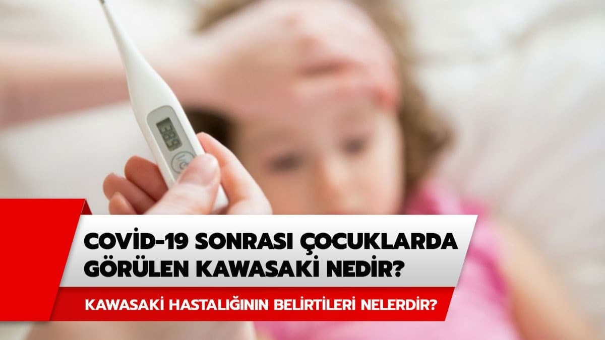 Koronavirs sonras ocuklarda grlen Kawasaki hastal nedir? ocuklarda grlen Kawasaki hastalnn belirtileri nelerdir?