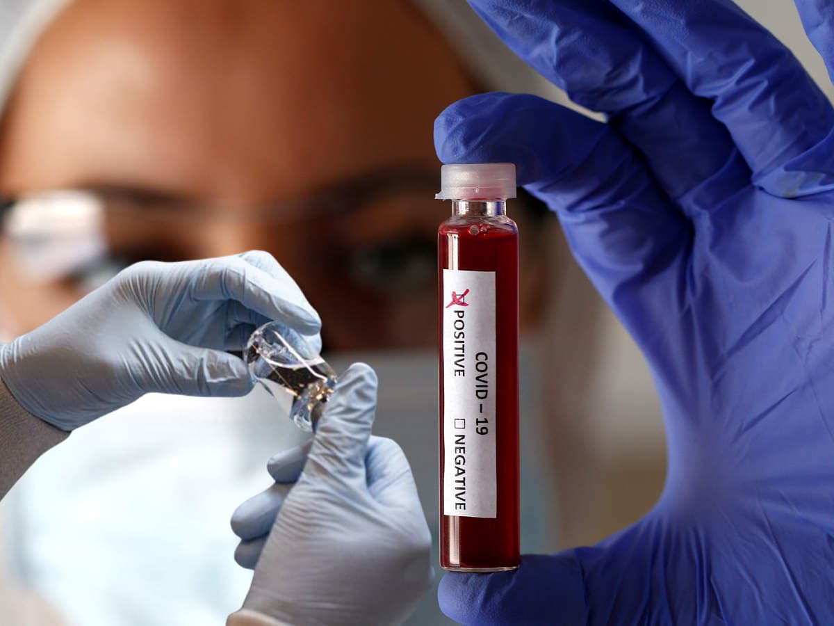 Endi�elendiren koronavir�s a��klamas�: A�� geli�tirilmezse 2028-2030 y�llar�nda...