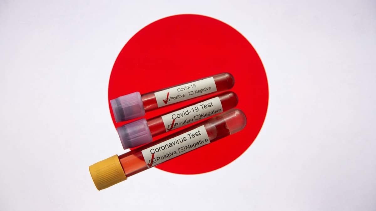 Japonya'da koronavirs nedeniyle OHAL 31 Mays'a uzatld 