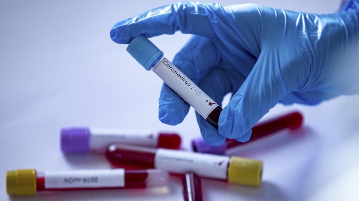 Singapur'da koronavirs vaka says 18 bin 700'e ykseldi
