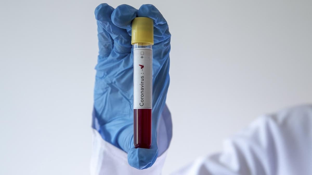 Hindistan'da rekor seviyede koronavirs vaka art yaand