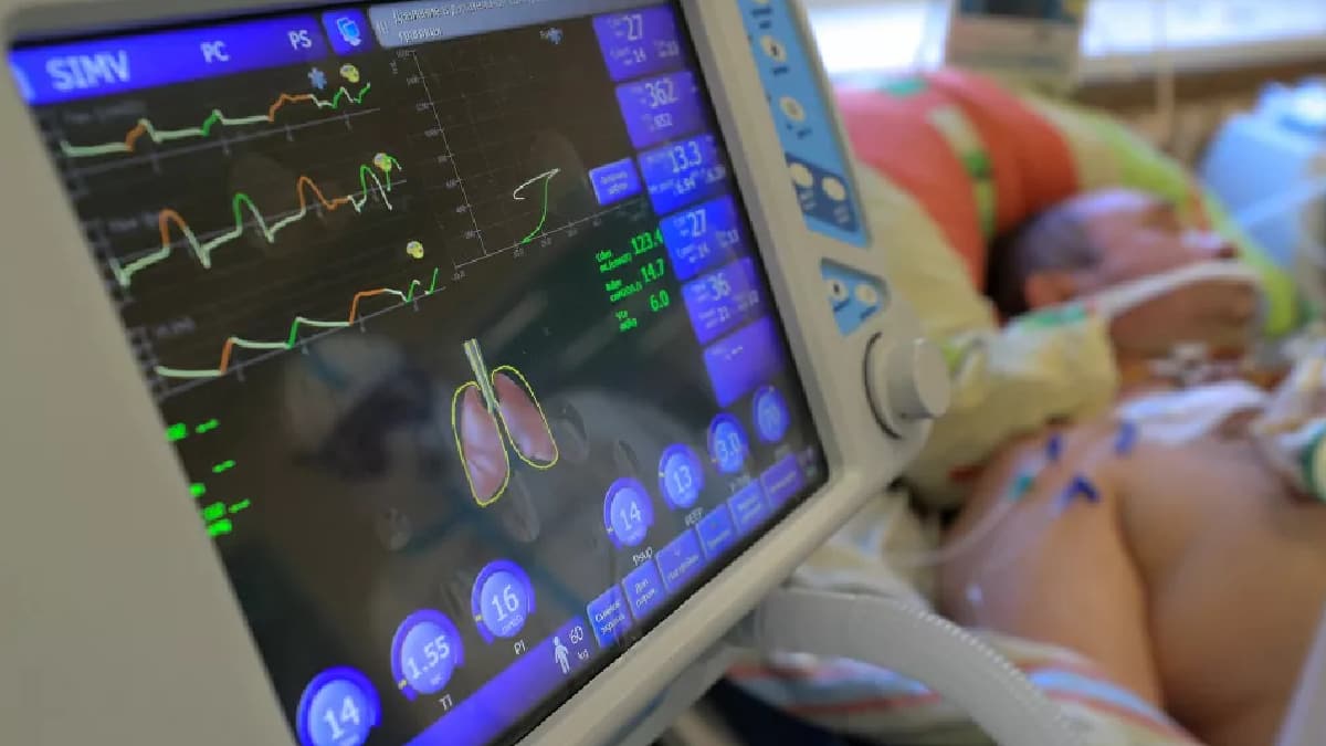 Rusya'da yang�nlara neden olan solunum cihaz�n�n kullan�m� durduruldu