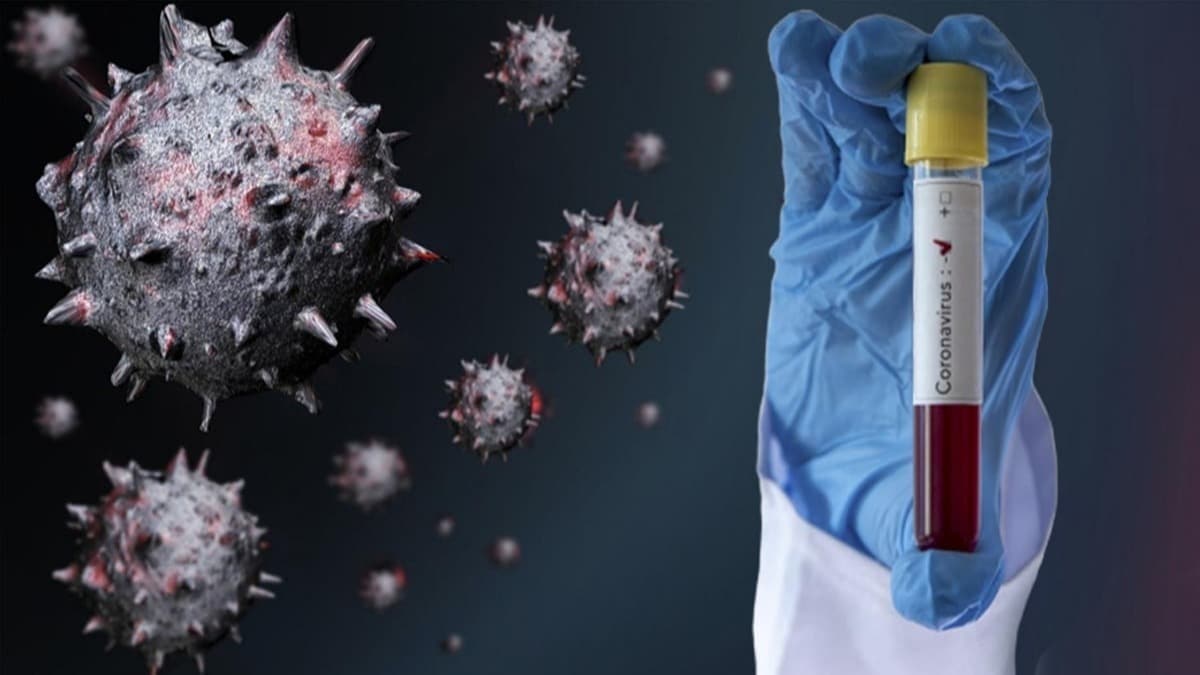 Arap lkelerinde Kovid-19 kaynakl can kayplar ve vaka saylar artyor 