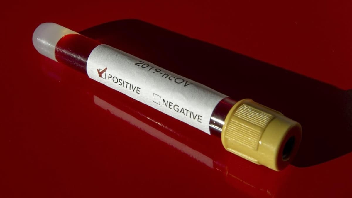 Singapur'da koronavirs vaka says 30 bini geti 