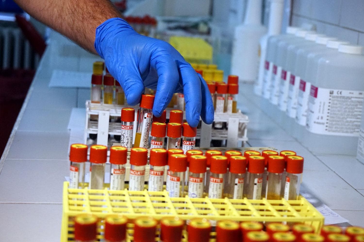 Antikor testleri ba�lad�! Belirti g�stermeyenler de tespit edilecek