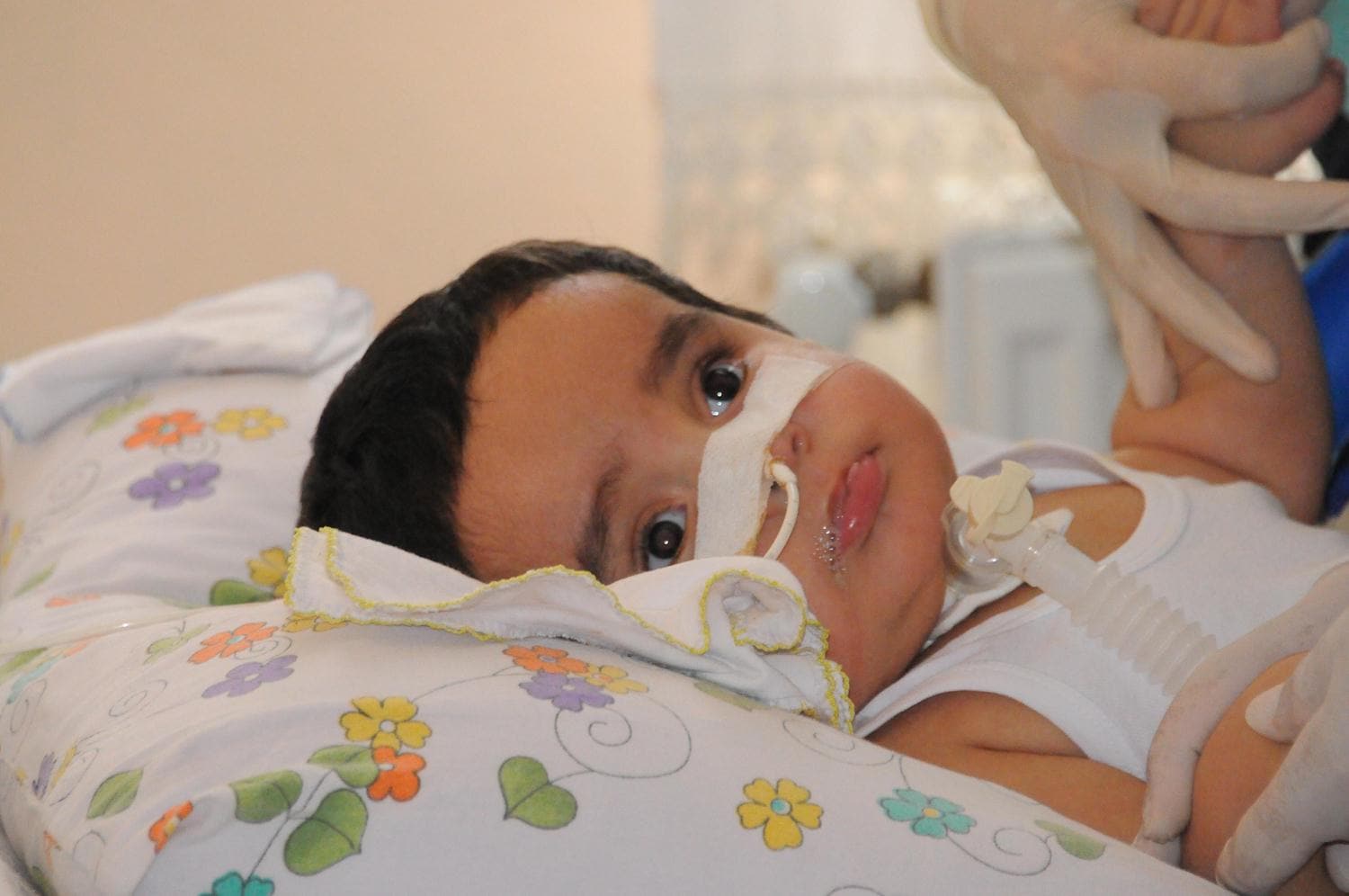 1.5 ya��ndaki �mer Asaf, bo�az�na ka�an leblebi nedeniyle yata�a mahkum kald�