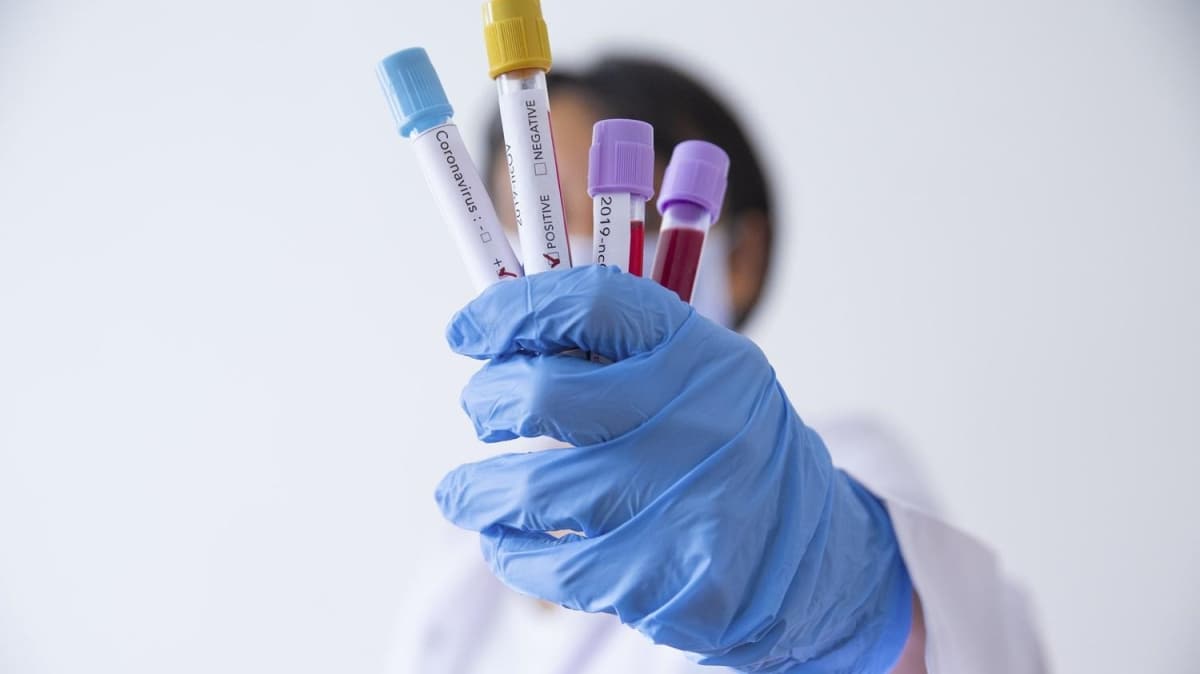 Yeni dalga endiesi yaanan Japonya'da korkulan oldu: 4 renci koronavirse yakaland