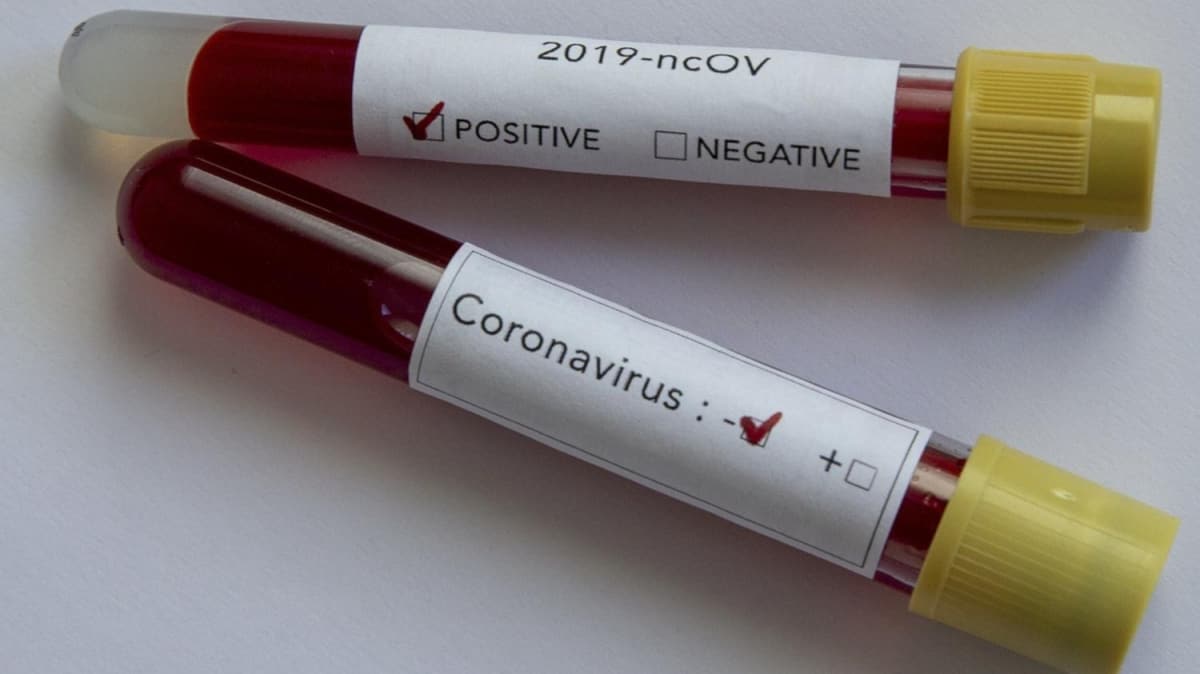 Yeni Zelanda'da 10 gndr yeni koronavirs vakasna rastlanmad 