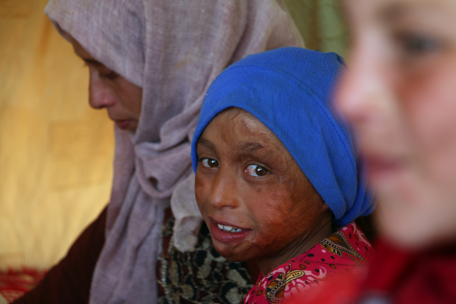 �� sava��n silinmeyen haf�zas�: Suriyeli �ocuklar