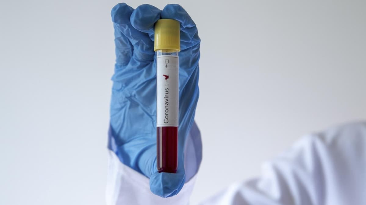 Pakistan'da son 24 saatte 4 bin 688 yeni koronavirs vakas tespit edildi