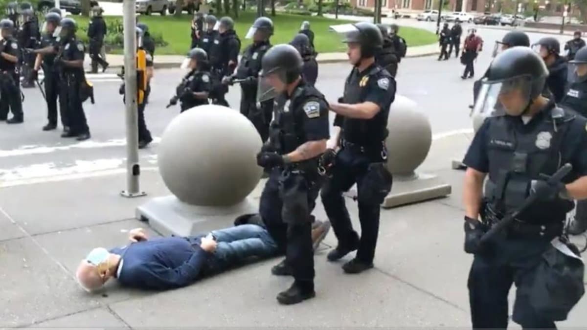 ABD'de polisin ittii yal adam kafa travmas geirdi