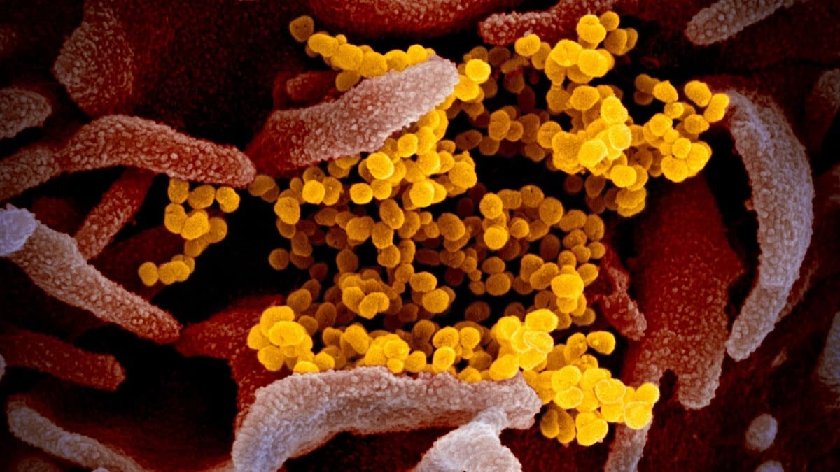 Dnya genelinde koroanvirs vaka says 6 milyon 980 bini geti