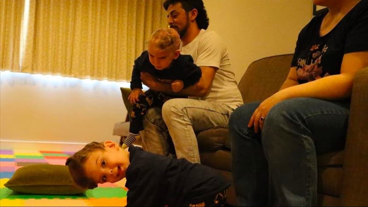 Bakan Erdoan, ngiltere'de operasyonla ayrlan siyam ikizlerinin ailesiyle grt 