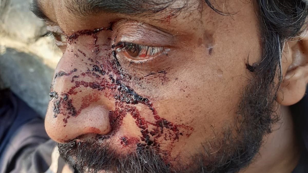 Uluslararas Af rgt, Hrvat polisinin snmaclara ynelik ikencelerine dikkati ekti