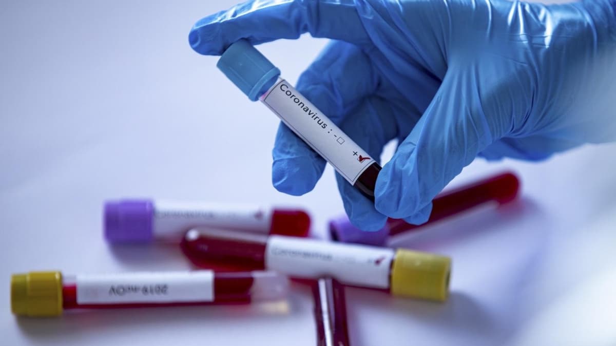 ran'da yeni tip koronavirs nedeniyle hayatn kaybedenlerin says son 24 saatte 113 artarak 8 bin 950'ye ykseldi