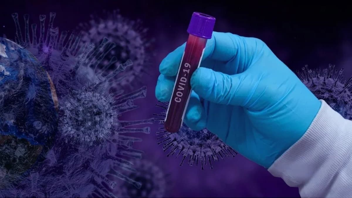 Sanayi ve Teknoloji Bakan Varank: Sanayide antikor testlerine 13 ilimizde balyoruz