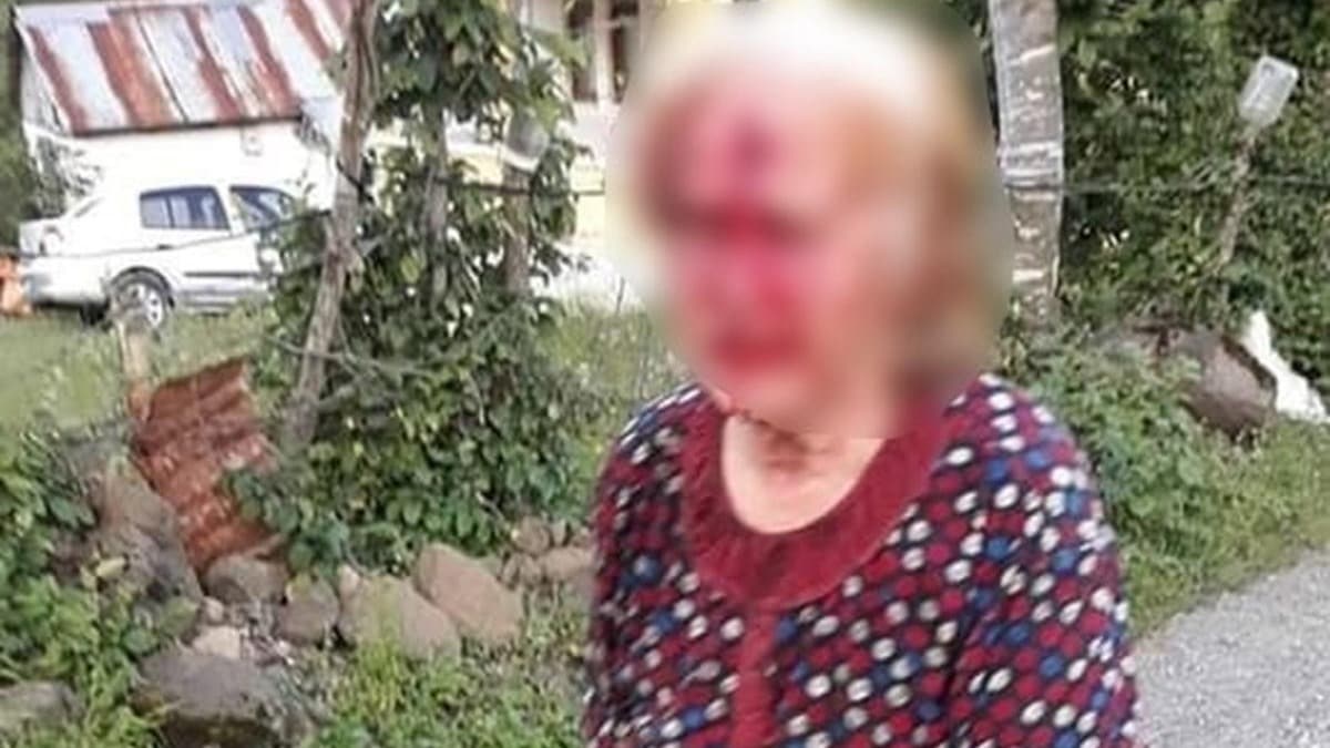 Yengesine baltayla saldrd!