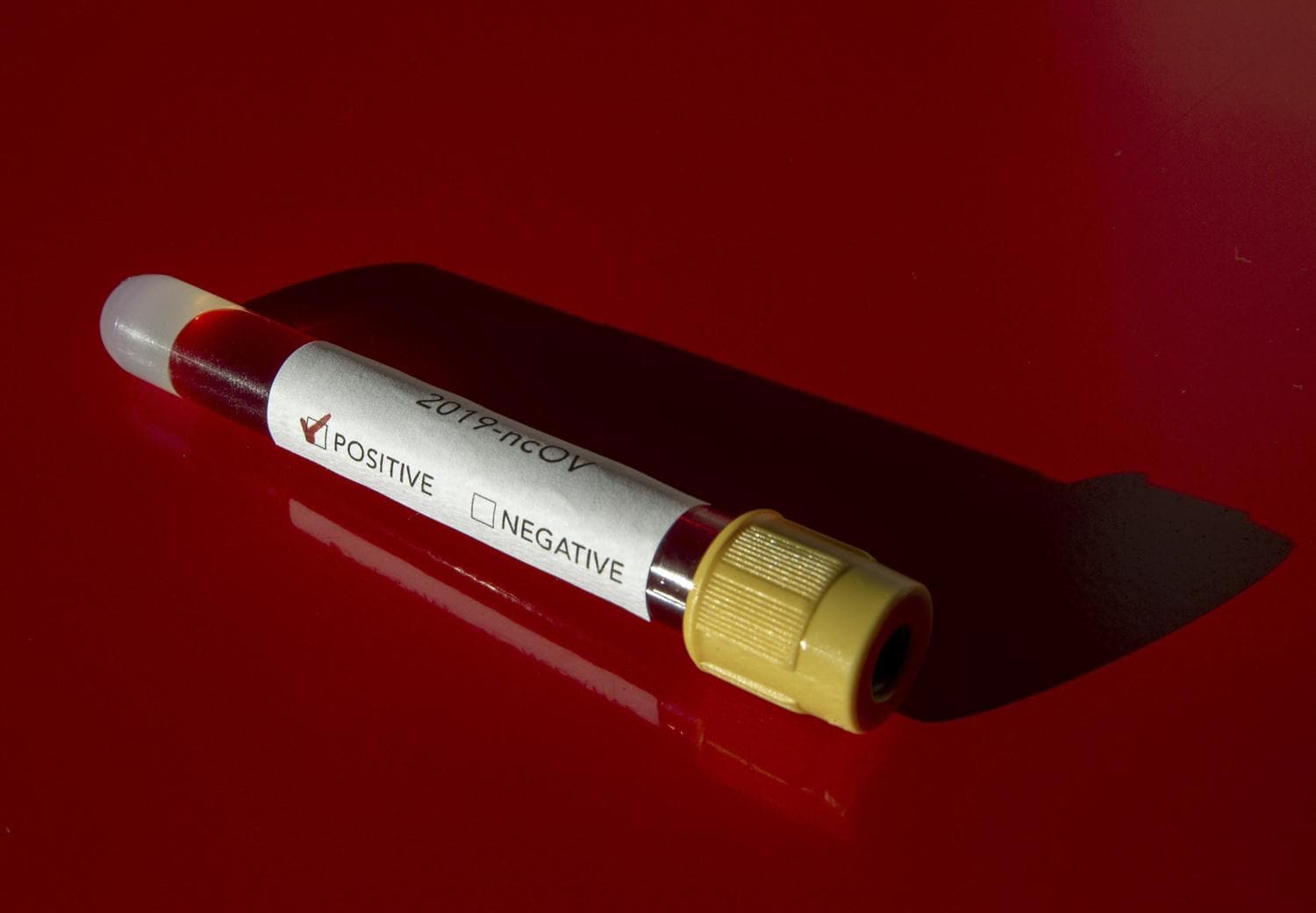 �ili'de koronavir�s raporu: �l�mler resmi rakam�n iki kat�