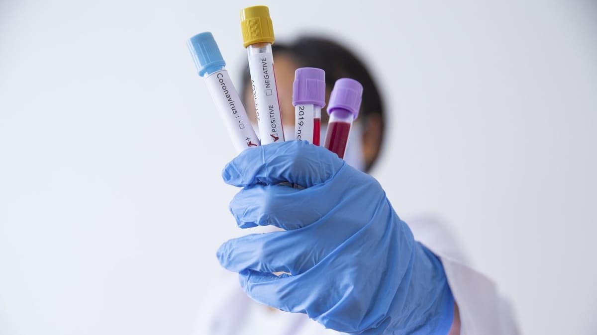 Her kas ars Kovid-19 olmayabilir