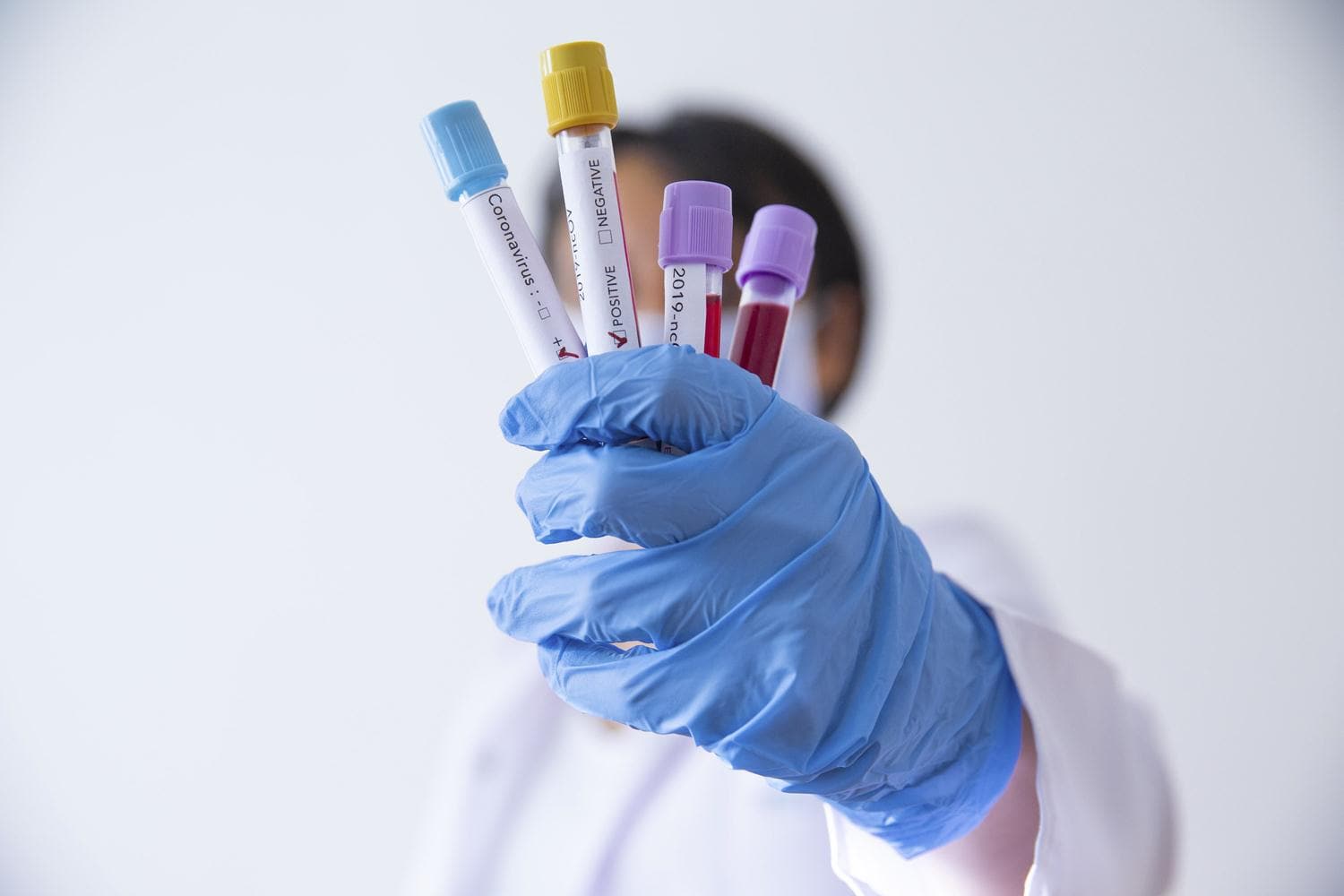 Her kas a�r�s� Kovid-19 olmayabilir