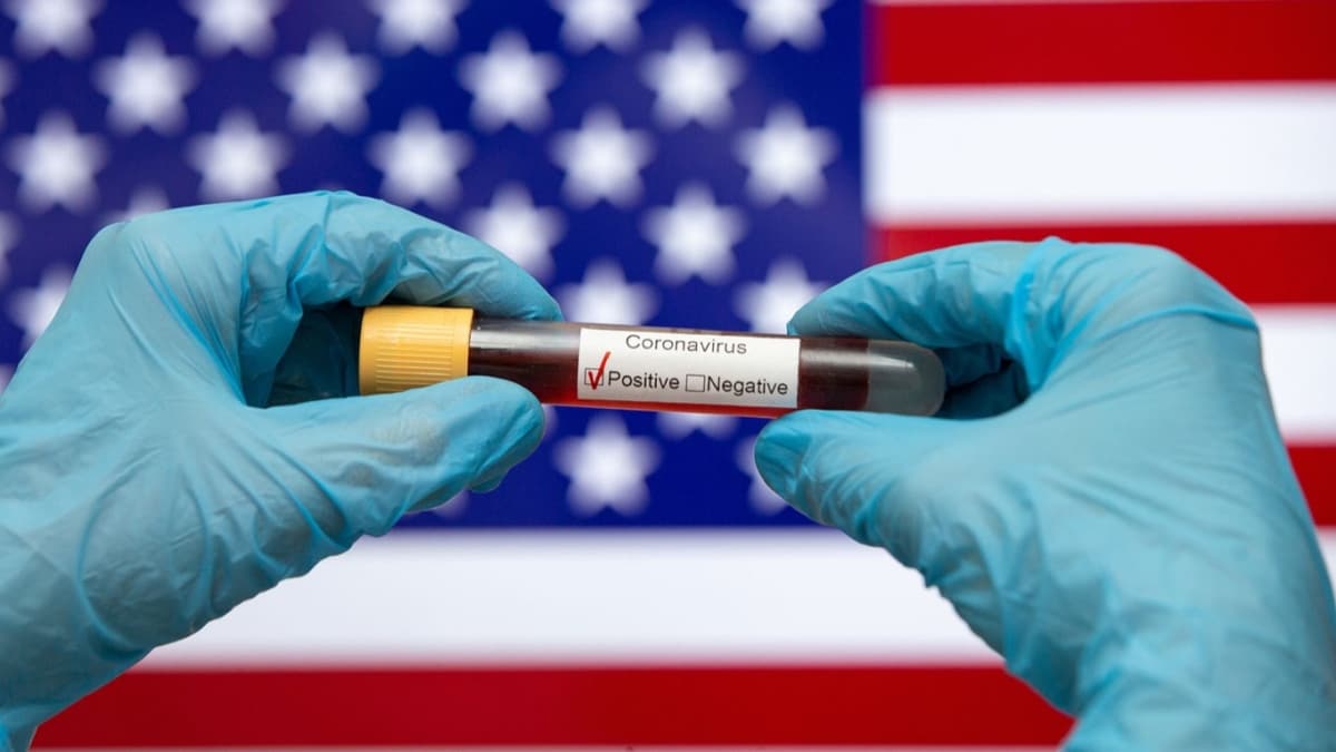 ABD'de bir gnde Kovid-19'dan 400 can kayb