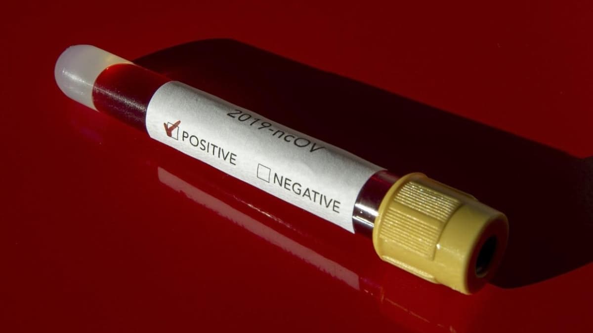 Senegal'de koronavirs vakas says 6 bini geti 
