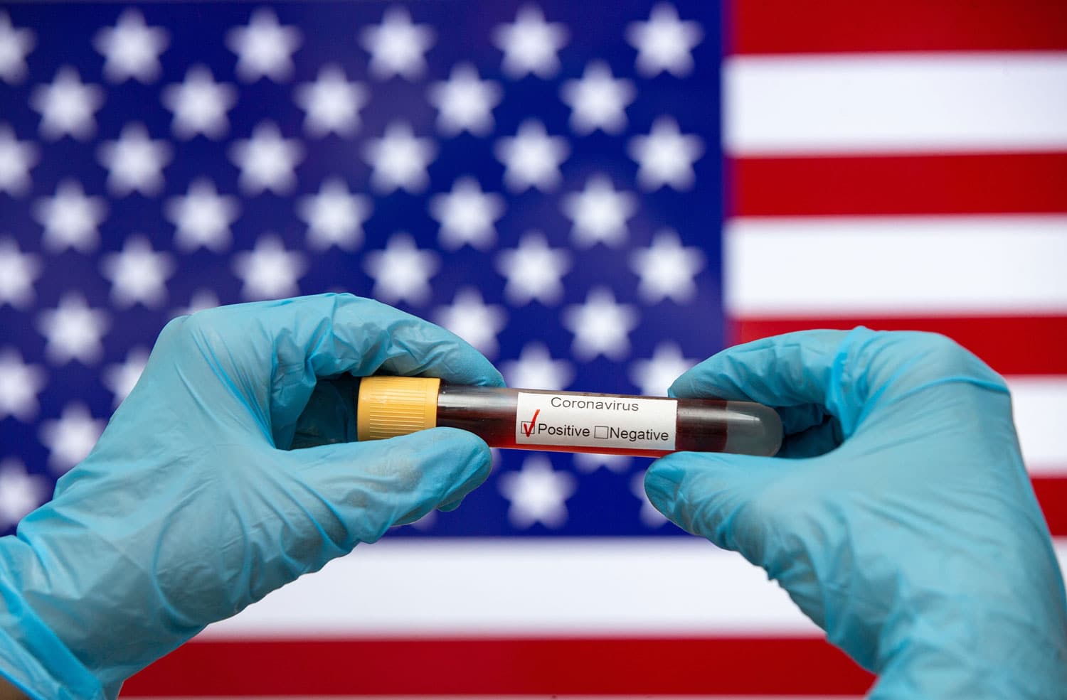 ABD'de a��r bilan�o: Son 24 saatte...