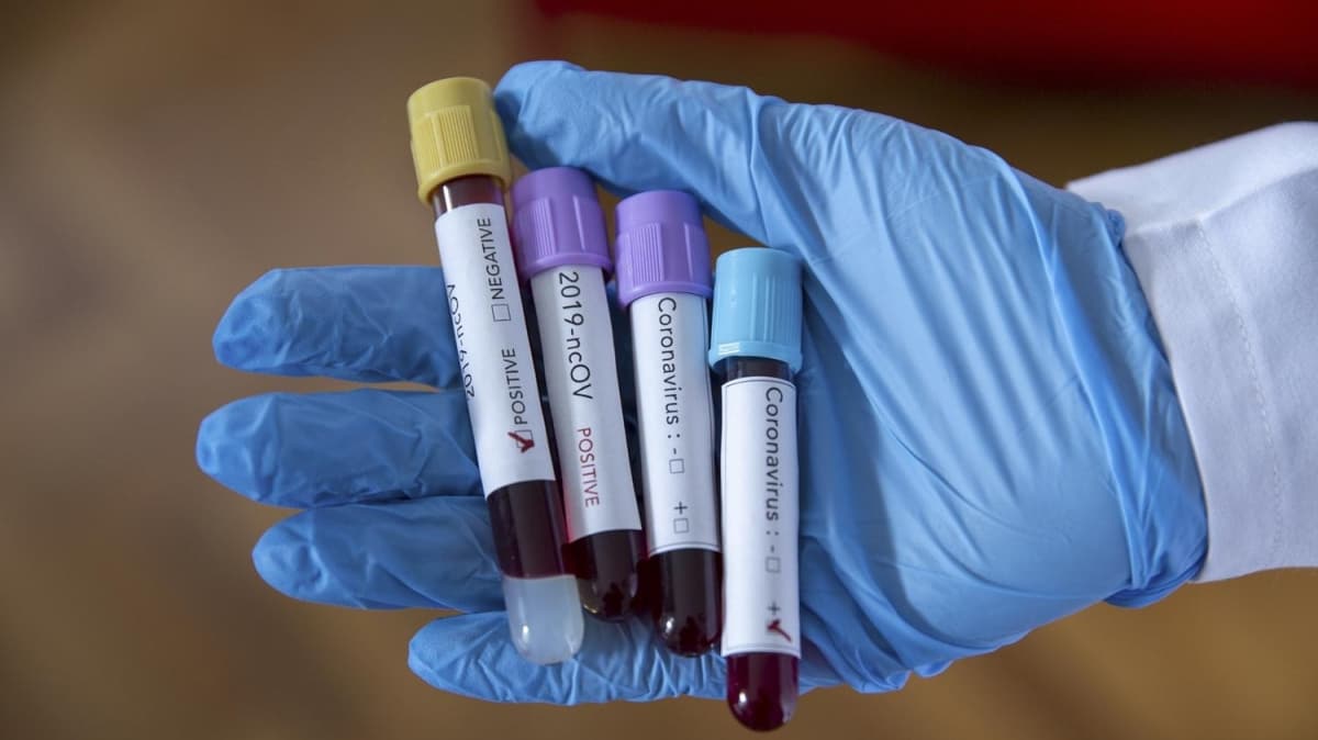 Suudi Arabistan'da bir gnde 4 bin 387 koronavirs vakas tespit edildi 