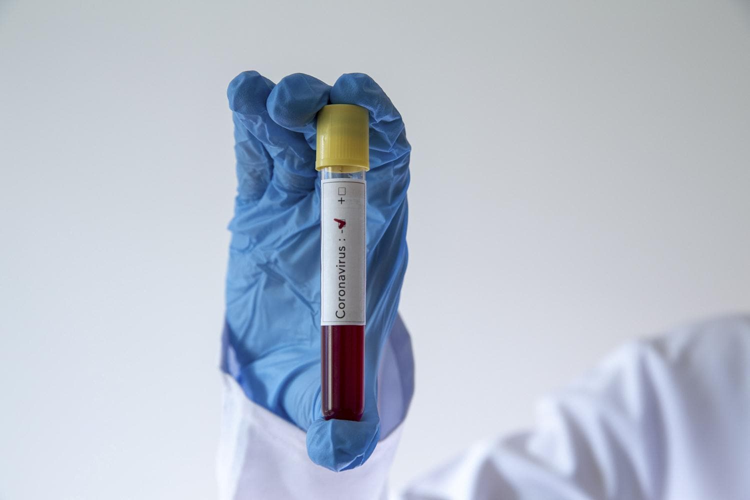 Avustralya'da vaka art��� s�r�yor