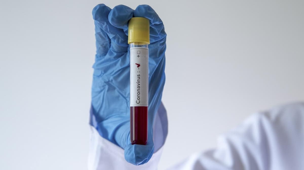 KKTC'de endielendiren gelime: 75 gn sonra 4 yeni koronavirs vakas grld