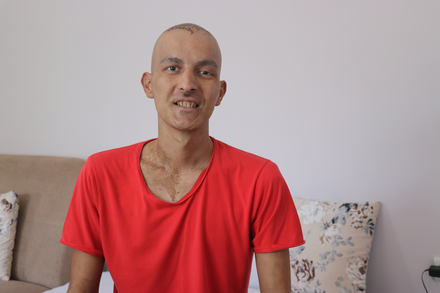 25 ya��ndaki Efecan'�n tek hayali k�k h�cre nakli olup ��rencilerine kavu�mak