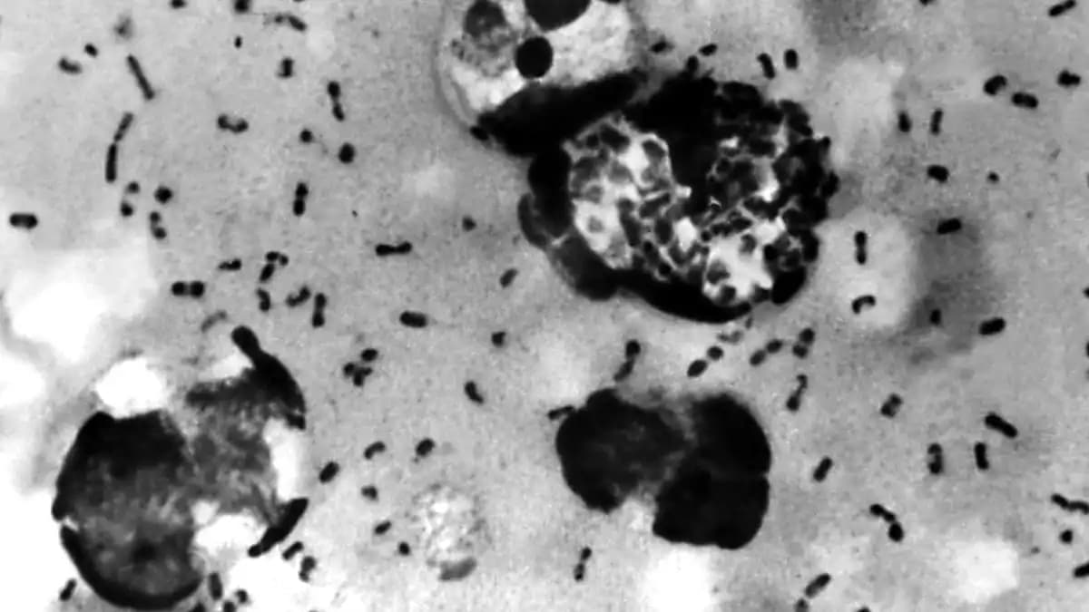 �nsanlarda kemirgenlerin ta��d��� pirelerin �s�rmas�yla geli�iyor: �ki �lkede h�yarc�kl� veba ��phesi