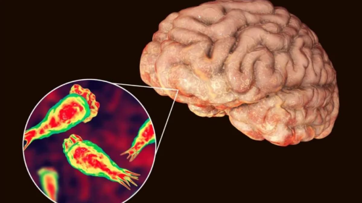 Vakalar �l�mc�l: Burun yoluyla bula��yor, beyin yiyor