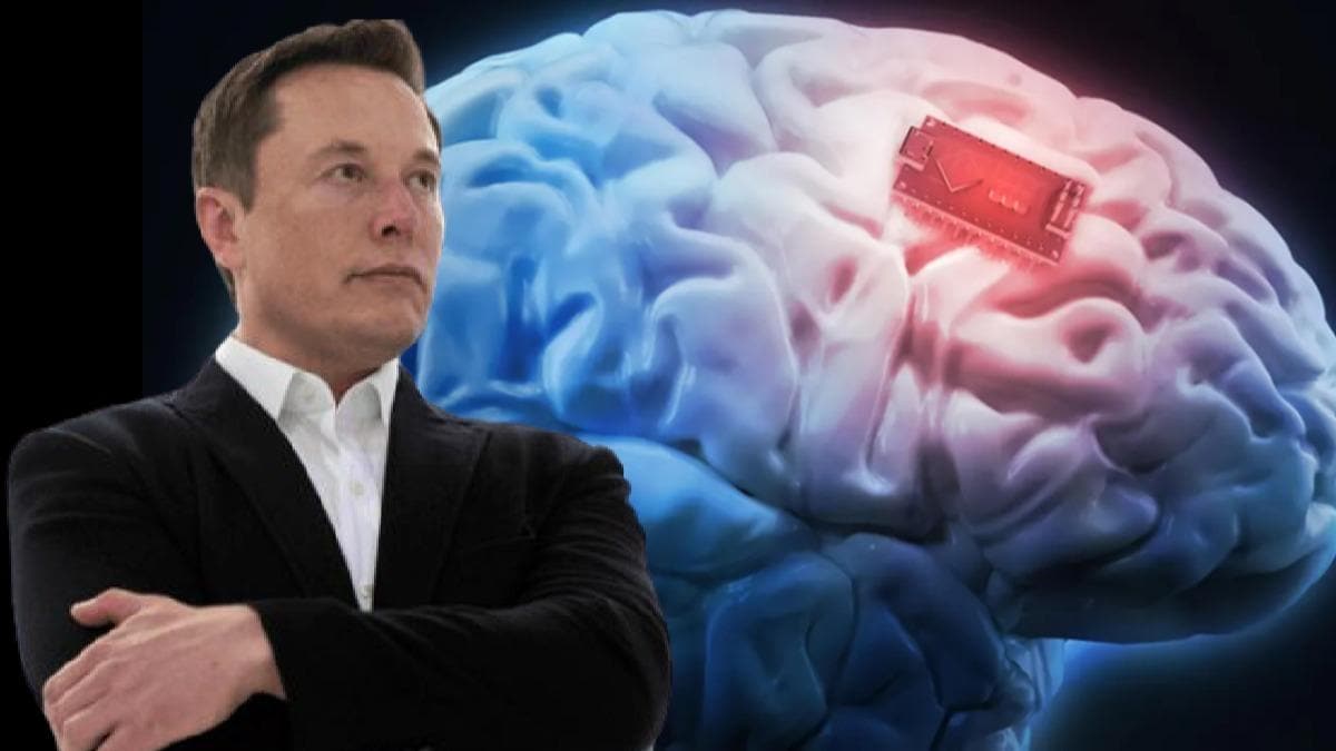 Elon Musk'n yeni lgn projesi: nsan beynine ip takacak