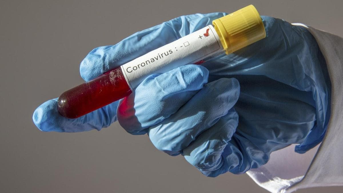 Singapur'da yeni bir koronavirs test kiti gelitirildi: Sreyi 4 saatten 2 saate indiriyor 