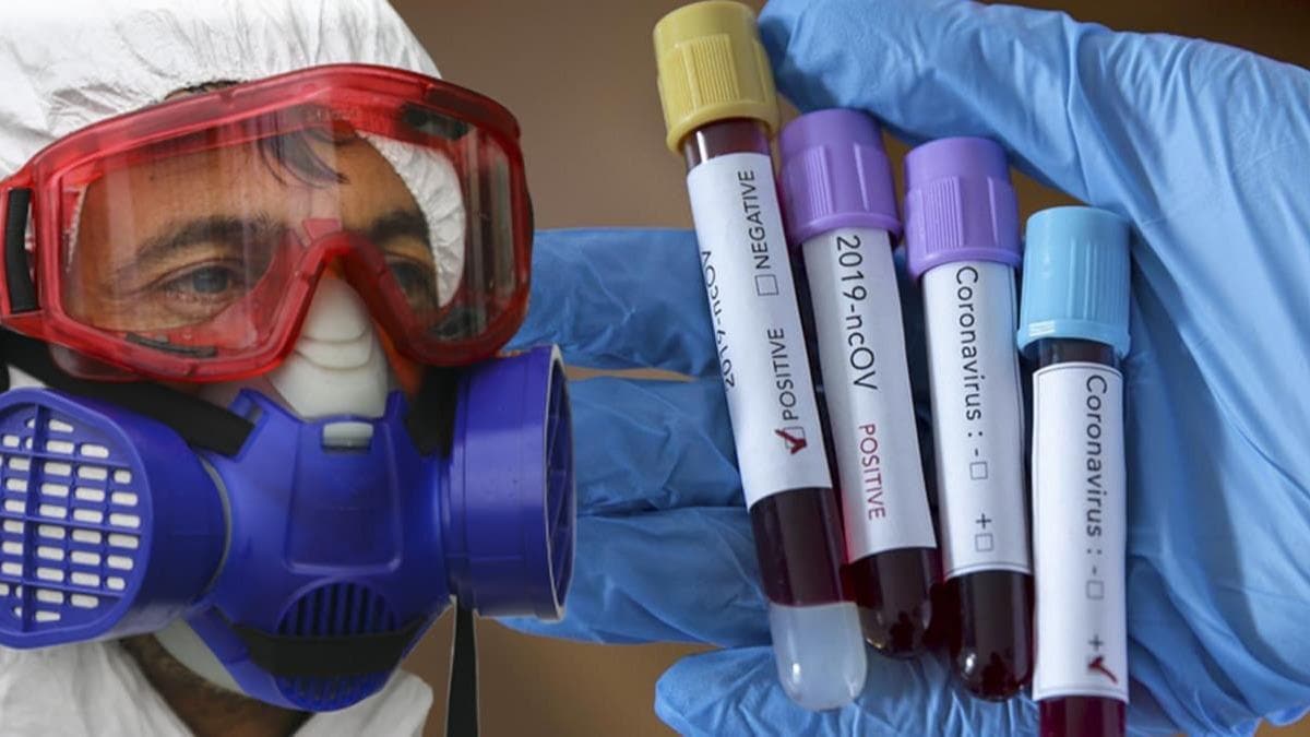 Rusya'da tespit edilen koronavirs vaka says 783 bini geti