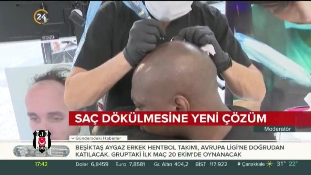 S.M.P tekniği artık Türkiye'de