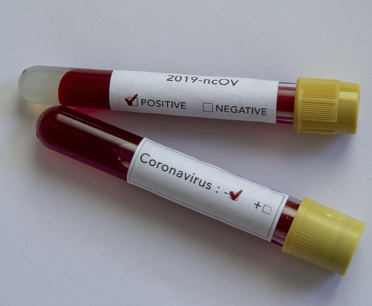 D�nya genelinde Kovid-19 bula�an 9,5 milyondan fazla ki�i sa�l���na kavu�tu