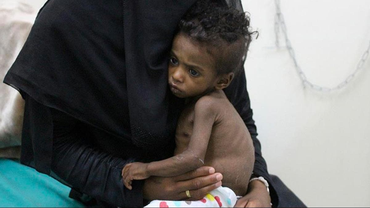 nsani kriz hi bu kadar ktye gitmemiti... BM'den Yemen'de ktlk uyars