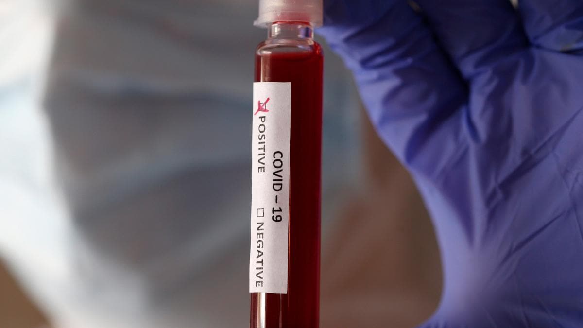 Hzl koronavirs antijen testi retecekler: 15 dakikada sonu verecek