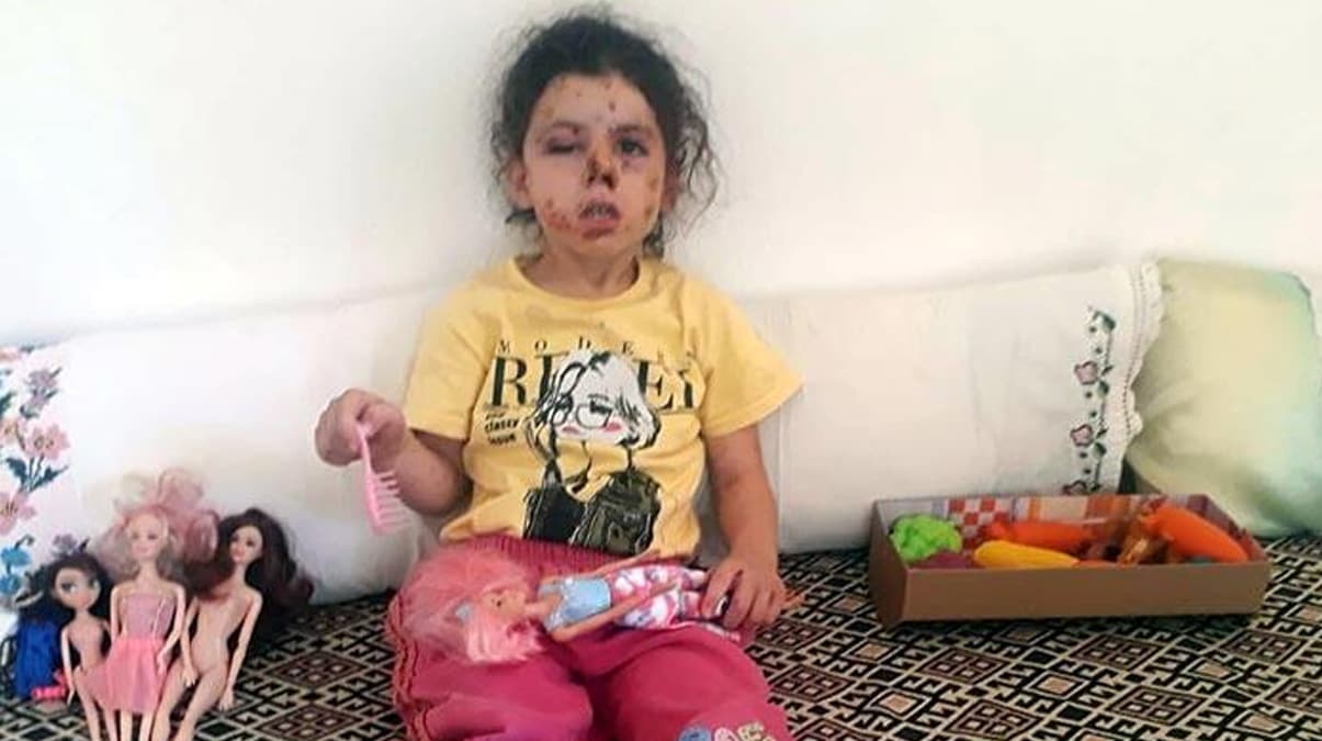Minik Neriman'� bu hale getirdiler