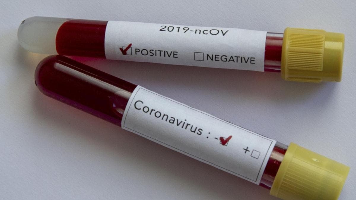 ABD'de koronavirs nedeniyle son 24 saatte 1136 kii ld 
