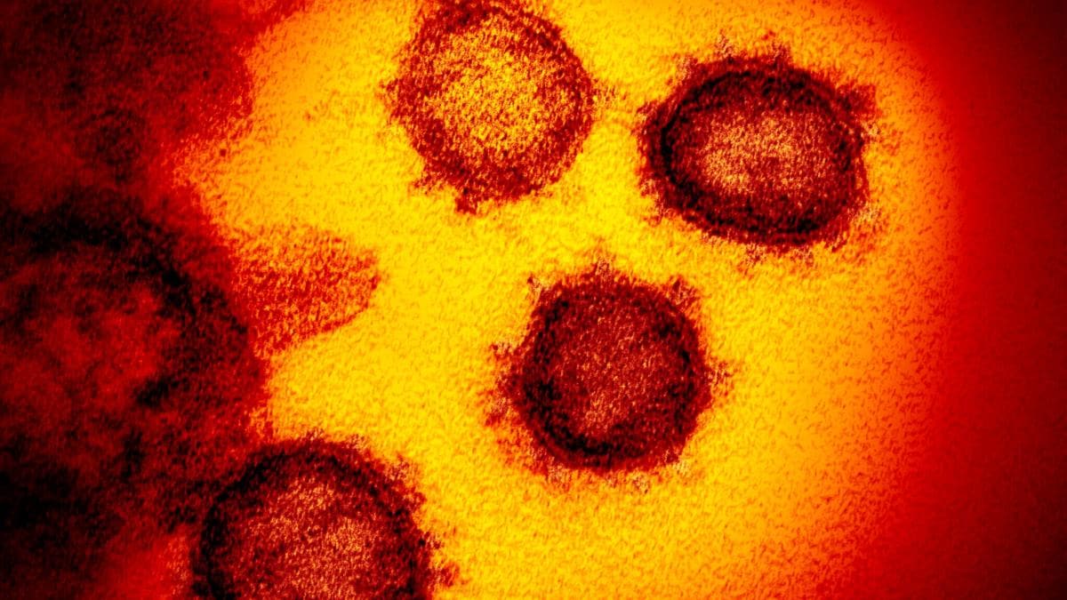 Avrasya lkelerinde koronavirs salgn yaylmaya devam ediyor