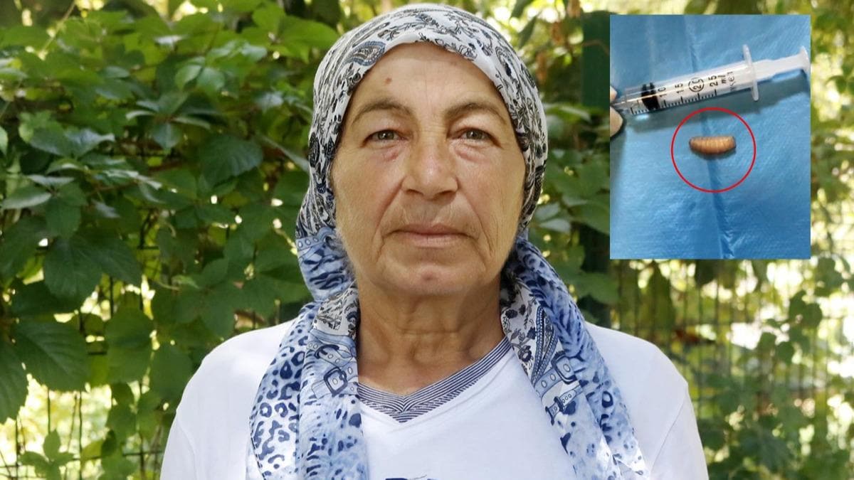 Burun aknts ikayetiyle doktora gitti, burnundan kanlar hayrete drd