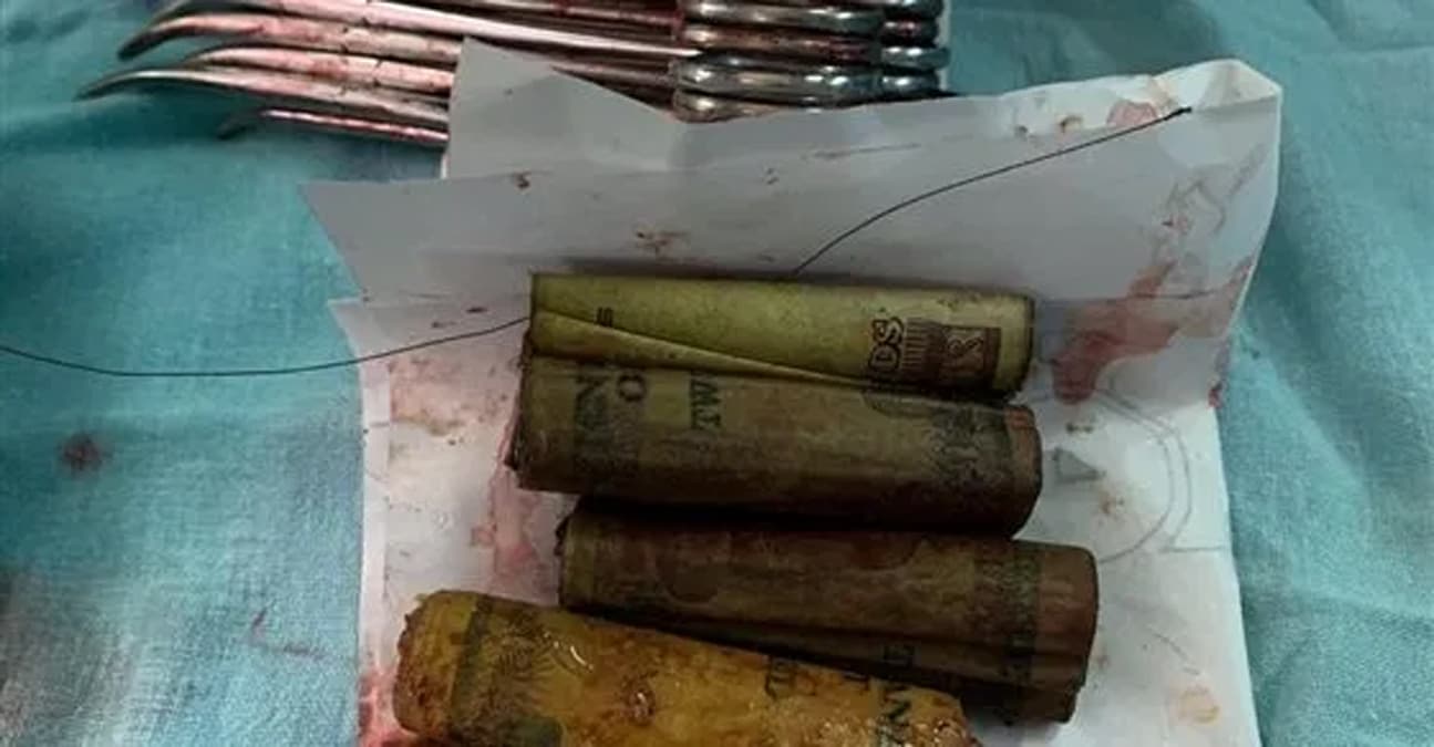 �nan�lmaz olay! Hepsi midesinden ��kt�