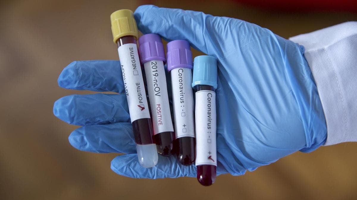 srail'de koronavirs vaka says artmaya devam ediyor