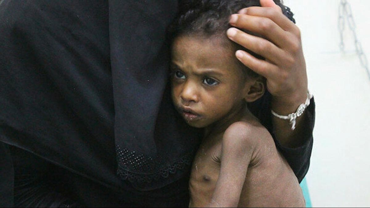 DS ve UNICEF duyurdu: Sudan ve Yemen'de ocuk felci salgn yaylyor